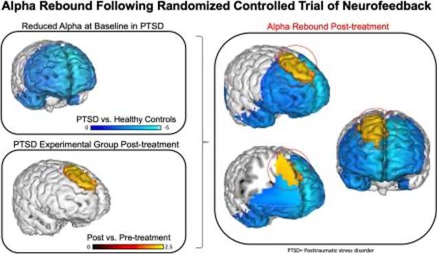 Alpha Brain Rhythms