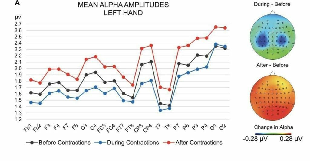 Beckman Alpha Brain Wave Study Graphic 